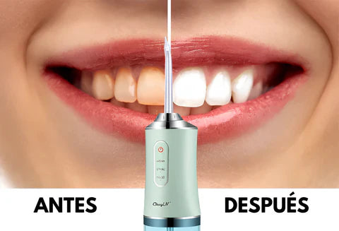 Irrigador Bucal - Blanqueador