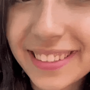 2x1 Carillas Dentales: La Solución Perfecta para una Sonrisa Impecable