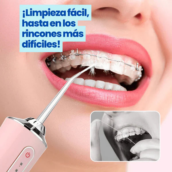 Irrigador Bucal - Blanqueador